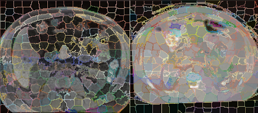 MRI and CT Supervoxels